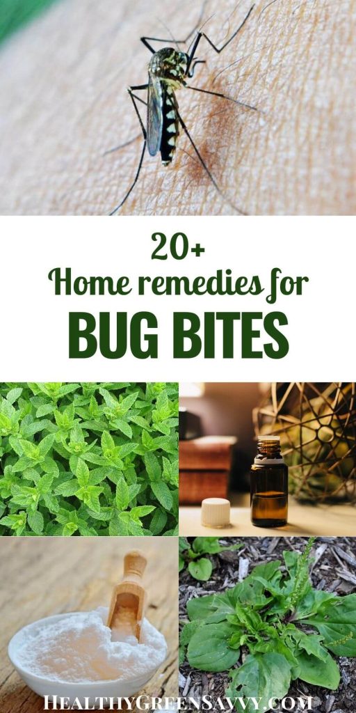 Home Remedies For Mosquito Bites 20 Ways To Stop Itch Fast