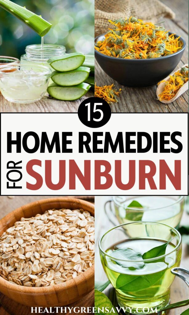 pin with photos of natural sun burn remedies plantain, aloe, calendula, oatmeal, and green tea plus title text