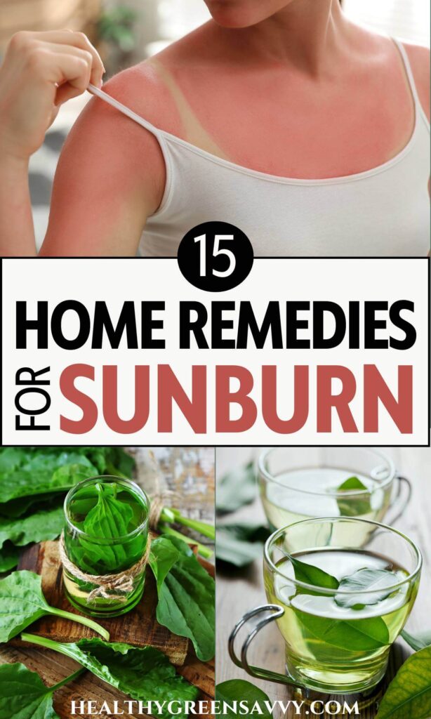 pin with photos of woman in tank top with sunburned skin and natural sun burn remedies plantain and green tea plus title text